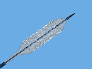 Peripheral Intervention