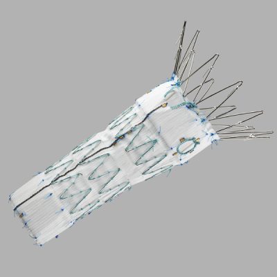 Zenith® Fenestrated