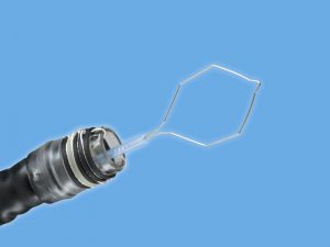 Endoscopic Mucosal Resection