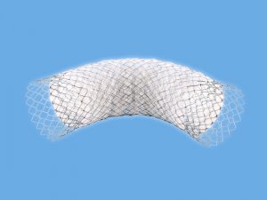 Oesophageal and Enteral Metal Stents