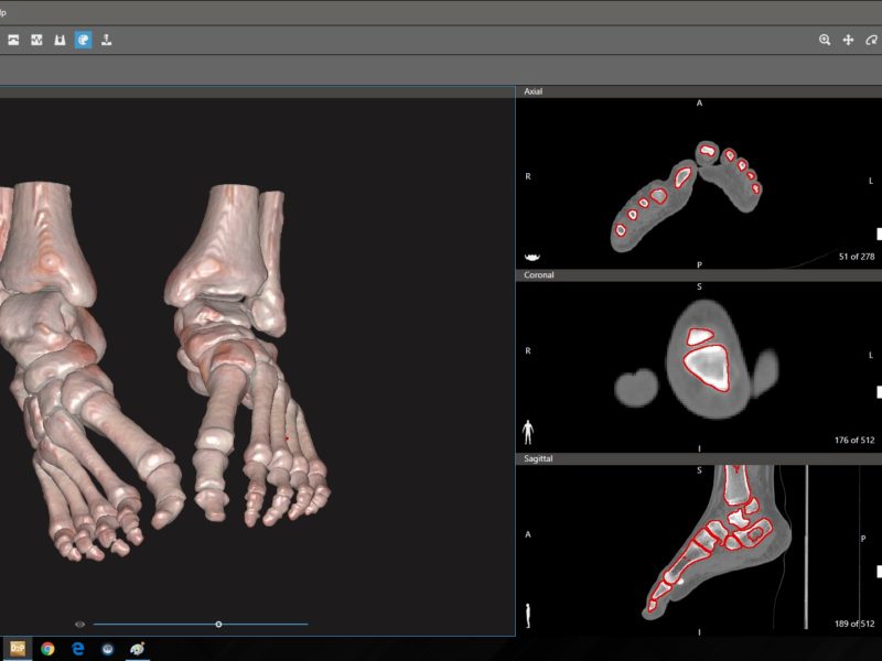 Orthopedics_Ankle_2
