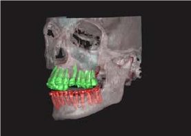 Teeth Module