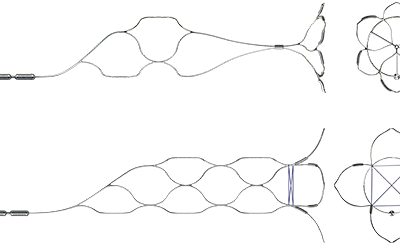 phenox Bifurcation Aneurysm Implant pCONUS 1 & pCONUS 2