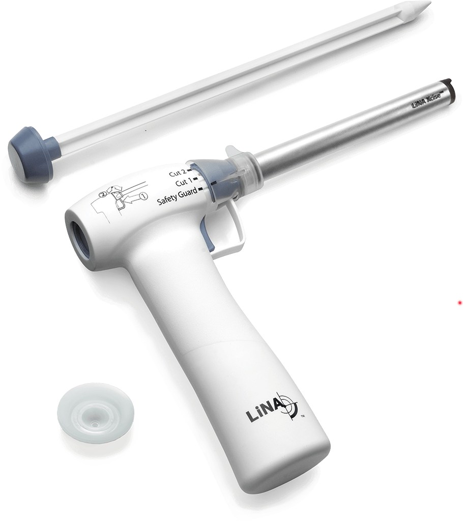 LiNA Xcise™ Cordless Laparoscopic Morcellator