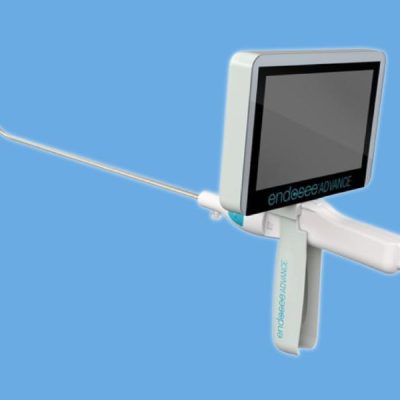 Hysteroscopy